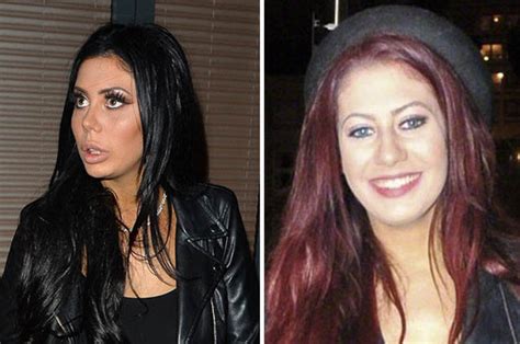 chloe ferry cosmetic surgery